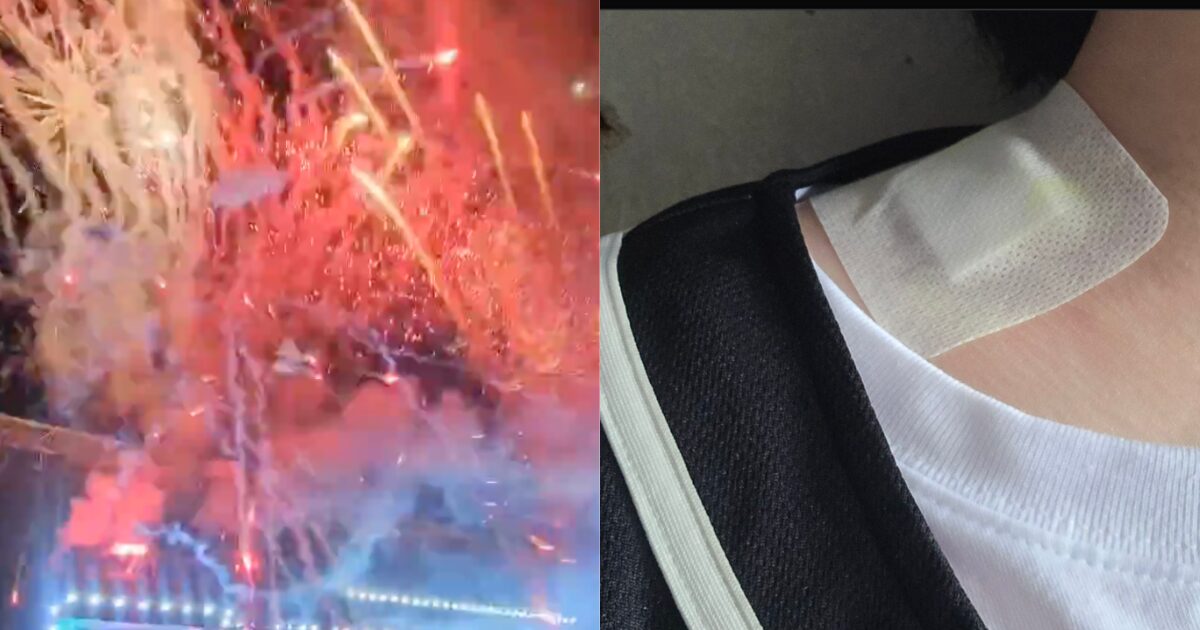 SEVENTEEN: Травми на концерті через несправність феєрверку